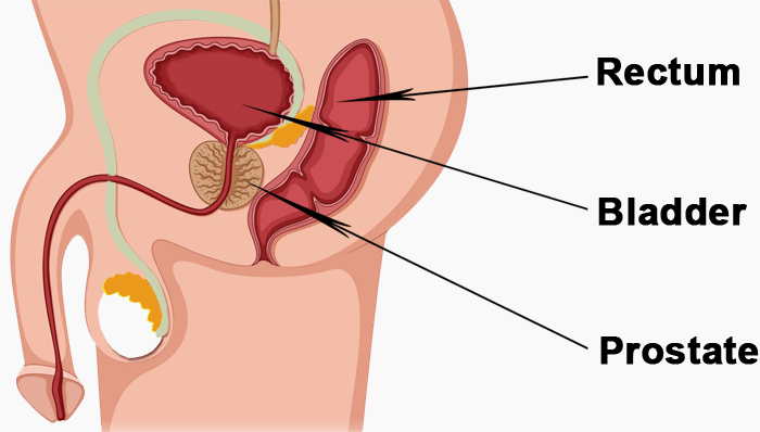 schéma de la prostate
